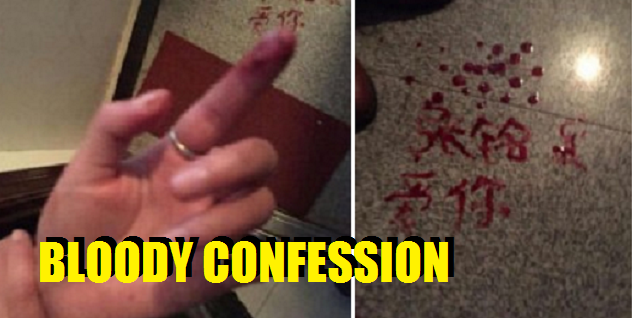 Girl writes love note in blood! - World Of Buzz 1