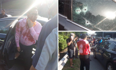 Man escapes Death after being shot 6 times in drive-by shooting - World Of Buzz 11