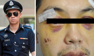 Man Lodges Police Report After Being Assaulted, Finds Out They Were Actually Cops! - World Of Buzz