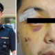 Man Lodges Police Report After Being Assaulted, Finds Out They Were Actually Cops! - World Of Buzz