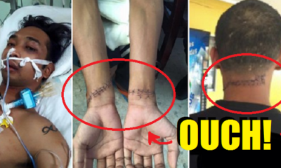 Rape Suspect Wakes Up to 50 stitches, Claims He Was Battered by Police - World Of Buzz 5