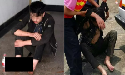 Six-Day Gaming Binge Caused This Guy's Feet to... Rot??! - World Of Buzz