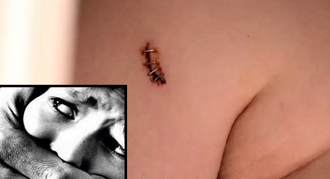 Husband Catches Man Raping His Wife and Literally Stabs Him in the Back - World Of Buzz