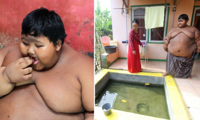 Obese 10-year old boy weights as much as an adult male lion - World Of Buzz 12