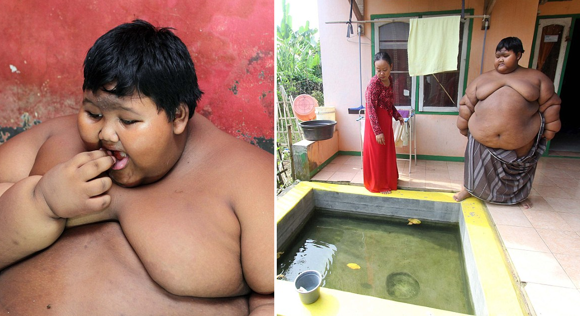 Obese 10-year old boy weights as much as an adult male lion - World Of Buzz 12