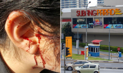 Taxi Driver Robs and Injures Woman Near Subang Parade - World Of Buzz 3