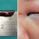 Boy Narrowly Escapes Blindness After Freak Accident Lodges Chopstick In Eye Cavity - World Of Buzz 2