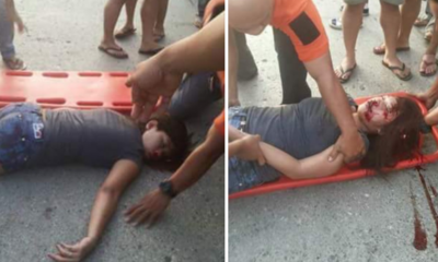 Girl suffers from Accident after She ran into the Middle of the Road to catch a Pokemon - World Of Buzz