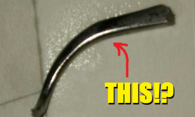 Surgical instrument left inside a woman after an operation in India - World Of Buzz 2