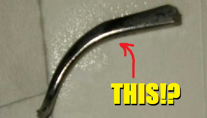 Surgical instrument left inside a woman after an operation in India - World Of Buzz 2