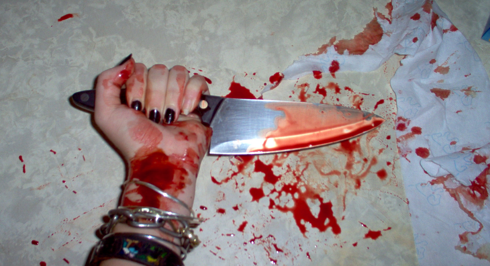 Woman paid to have her limbs Chopped Off in bid of Insurance Fraud only to be Found Out - World Of Buzz 3