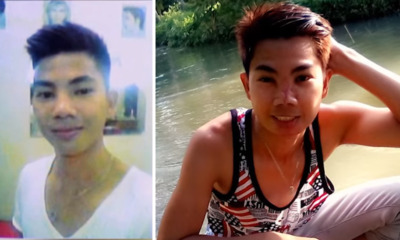 Guy's Life Turns Into a Living Nightmare After Going For RM45 Nose Job - World Of Buzz