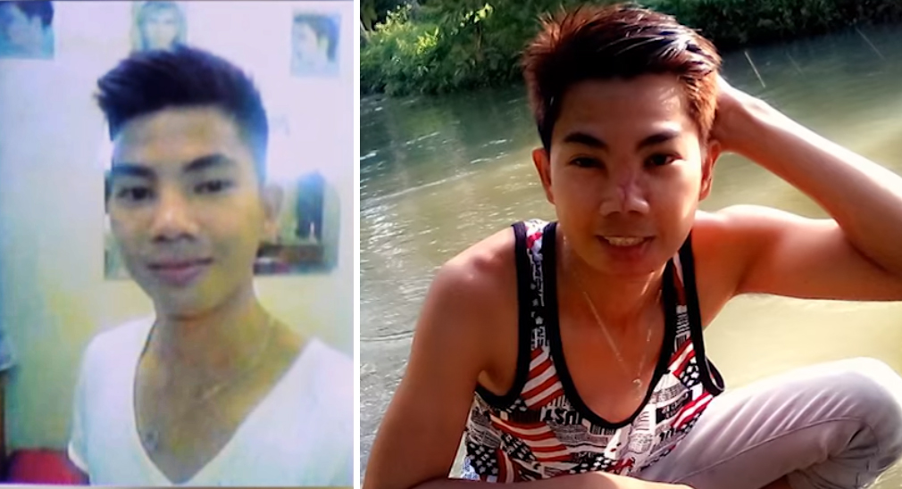 Guy's Life Turns Into a Living Nightmare After Going For RM45 Nose Job - World Of Buzz