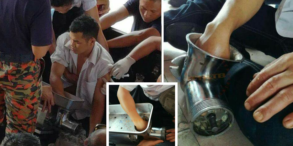 Malaysian Male Accidentally Gets Hands Stuck In Meat Grinder, Seeks Help By Himself - World Of Buzz 1