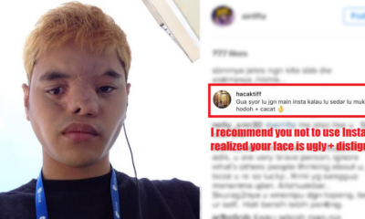 Malaysian Receives Extremely Nasty Comments About His Face, Strangers Step In to Support - World Of Buzz