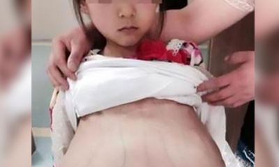 Man arrested after bringing PREGNANT 12-year old "wife" to the hospital for a check-up - World Of Buzz