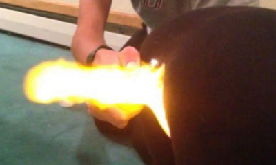 Patient Farts During Surgery in Japan, Causes Fire Outbreak - World Of Buzz