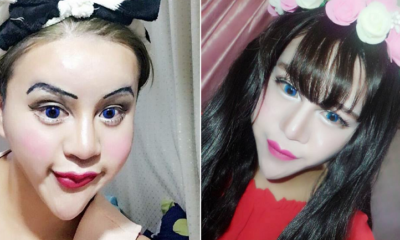 Chinese Shocks World With Intense Plastic Surgery For Bizarre 'Beauty' - World Of Buzz 10