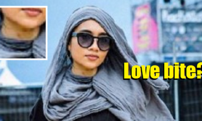 What Bit Yuna? Love Or Spider? - World Of Buzz 1