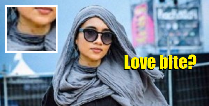 What Bit Yuna? Love Or Spider? - World Of Buzz 1