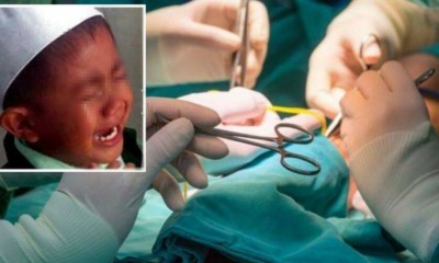Another Case of Circumcision Accident, This Time Involving A 9-Year-Old Boy - World Of Buzz