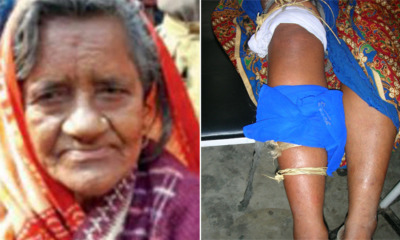Indian Woman Died From Cobra-bite, Comes Back To Live After 40 Years - World Of Buzz 4