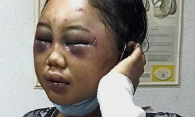 Indonesian Maid Brutally Abused by Malaysian Employer - World Of Buzz 3