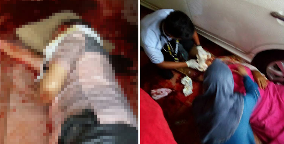 Man With 'Datuk' Title Gravely Injured By Group Of Robbers In Ipoh - World Of Buzz 6