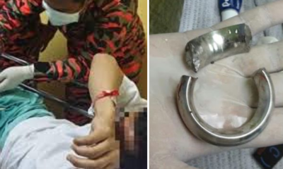 Metal Ring Stuck Around Malaysian Man's Penis Removed by Firefighters - World Of Buzz 4