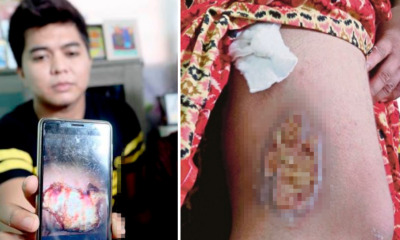 Refuse To Confess, Young Man Brutally Beaten Up By Police In Custody - World Of Buzz 5