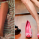 Woman Had To Amputate Her Lower Leg After Getting A Blister from Wearing Heels - World Of Buzz 3