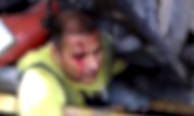 Worker's Leg Pinned Under Debris, Forced To Amputate On Scene To Keep His Life - World Of Buzz 3