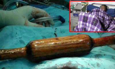 Abusive Husband Accused Wife Being Infertile, Forced A 40-cm Rolling Pin Up Wife's Anus - World Of Buzz 2