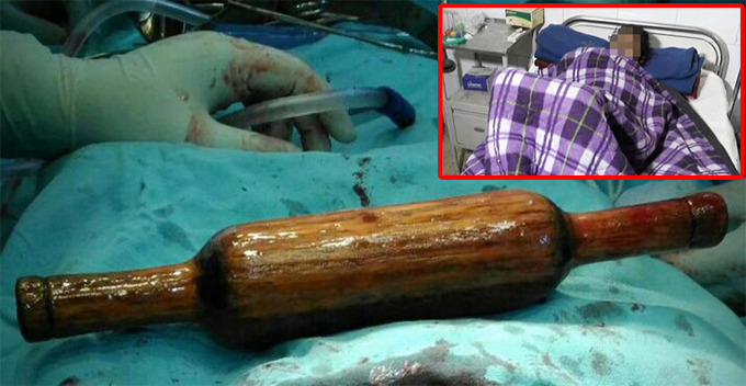 Abusive Husband Accused Wife Being Infertile, Forced A 40-cm Rolling Pin Up Wife's Anus - World Of Buzz 2