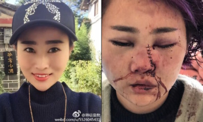 China Police accused of covering up brutal tourist attack!? - World Of Buzz