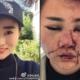 China Police accused of covering up brutal tourist attack!? - World Of Buzz