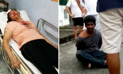 Gutsy women fought back against snatch thief despite injury! - World Of Buzz 5