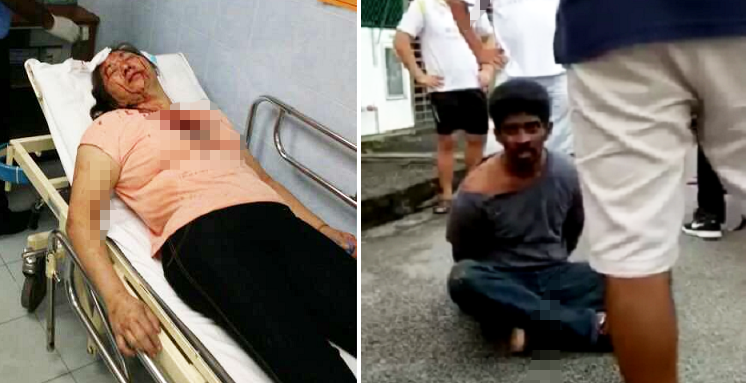 Gutsy women fought back against snatch thief despite injury! - World Of Buzz 5