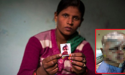 Innocent 2 YO Boy's Face Splashed With Acid, After His Mother Rejects A Man's Love - World Of Buzz