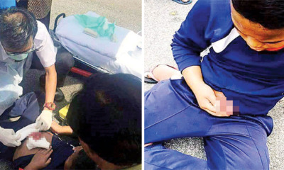 Malaysian Boy's Small Intestines Exposed After Stomach Penetrated By Bicycle Handle - World Of Buzz 2