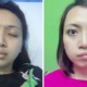Malaysian Woman Shares The Surprising Story Of Why Her Face Was Drooping On Side - World Of Buzz 11