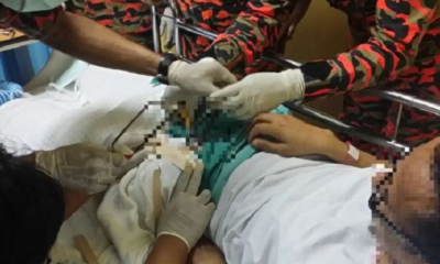 Penis Rings had fireman always busy. - World Of Buzz