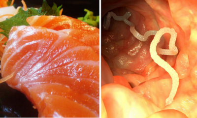 Sashimi Lovers In For A Surprise As Japanese Broad Tapeworms Found In Alaska-Caught Salmon - World Of Buzz