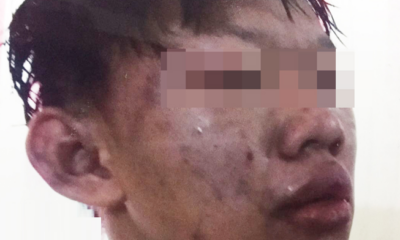 Student brutally beaten by gangsters for refusing gang invitation. - World Of Buzz 6