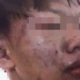 Student brutally beaten by gangsters for refusing gang invitation. - World Of Buzz 6