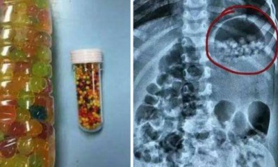 Chinese Couple Mistakenly Fed Almost 300 'Water Babies' To 3-Year-Old Daughter - World Of Buzz 5