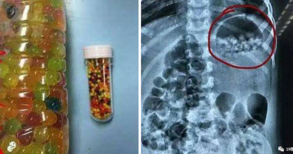 Chinese Couple Mistakenly Fed Almost 300 'Water Babies' To 3-Year-Old Daughter - World Of Buzz 5