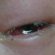Severe eye infection caused 3 Taiwanese to nearly lose their eyesight - World Of Buzz 1