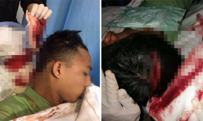 Snatch Thief Brutally Hacked Student's Head For Not Giving Up His Power Bank - World Of Buzz 1