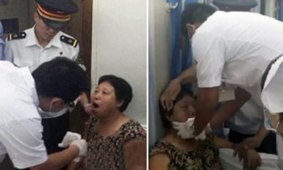 Chinese Woman Dislocates Her Jaw From Laughing Too Much - World Of Buzz 4